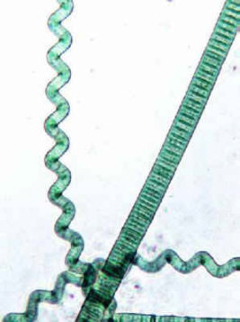 Une bact�rie en h�lice : la spirulline